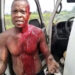 Police discipline personnel for smashing driver’s head with wood over N200