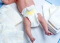 Doctors surprised as baby is born with 3 penises
