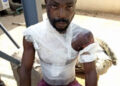 Wife pours hot water on husband for getting drunk