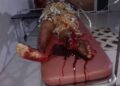 Bloody APC Congress in Ebonyi, as two shot dead, woman shot in the leg, others injured