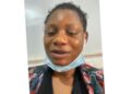 Nigeria Lady Cries Out After Loosing Right Eye To Contact Lens