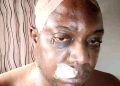 Former Reps Member Beats Husband To Pulp, Husband Begs For Divorce [PHOTOS]