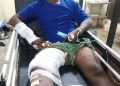 How Dangote sacked me after suffering broken ribs, limbs while driving company truck, driver tells court