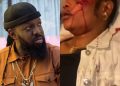 BREAKING: Timaya Arrested After Been Accused Of Hit-And-Run Incident That Left A Woman Bleeding [PHOTOS + VIDEO]