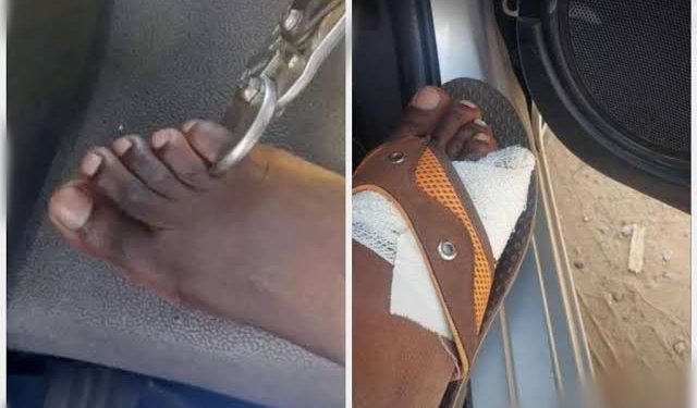 People Allegedly Cutting And Selling Of Their Toes Amidst Rising Cost Of Living [VIDEO]