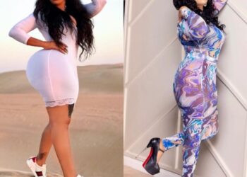 Popular Socialite Sidika Undergoes Surgery To Remove Butt Implants Due To Health Risks And Complications