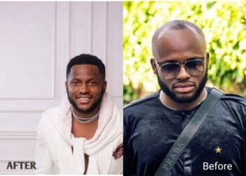 “Best $20,000 well spent” — Comedian I Go Save undergoes hair transplant