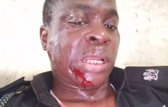 [PHOTOS] Two officers shot by Yoruba nation agitators in Lagos — Police