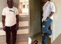 Man Undergoes Height Lengthening Surgery To Grow Taller [PHOTOS]