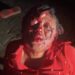 Man Disfigures Wife’s Face In Delta [PHOTOS]